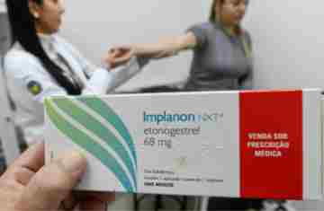  Implante contraceptivo deve ser ofertado por planos a partir de hoje 